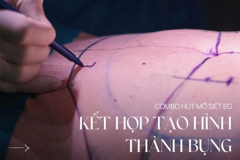 Combo Hút mỡ siết eo kết hợp tạo hình thành bụng